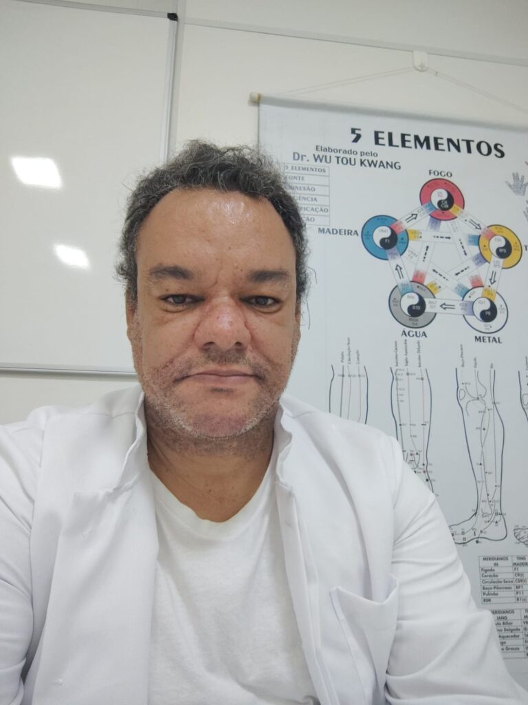 Eu-acu